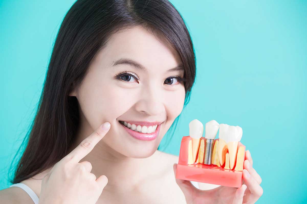 Woman holding tooth implant