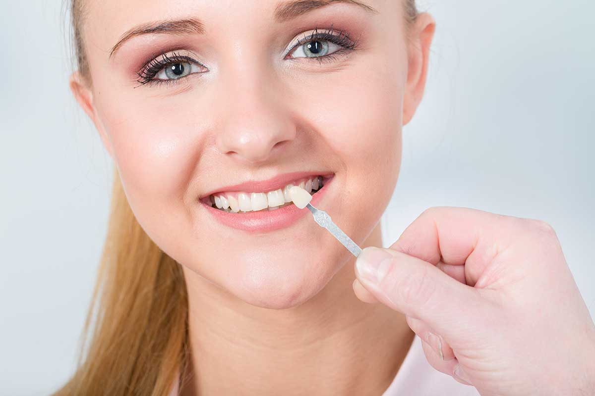 Using shade guide at girls mouth to check veneer of teeth for bleaching