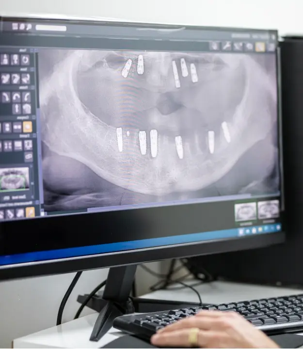 Dentist viewing computer-guided dental implant placement plan on monitor in Orlando practice.