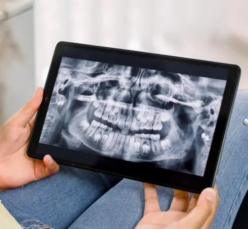 Dentist holding tablet displaying digital dental x-ray of patient's teeth and jaw.