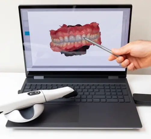 Intraoral camera displaying 3D digital model of patient teeth and gums during dental examination.