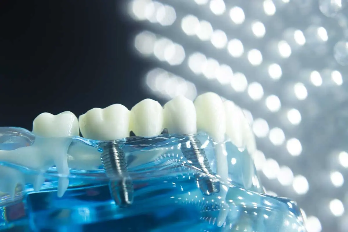 Toothbrush with dental implant models in blue mouthwash solution under bright lights.