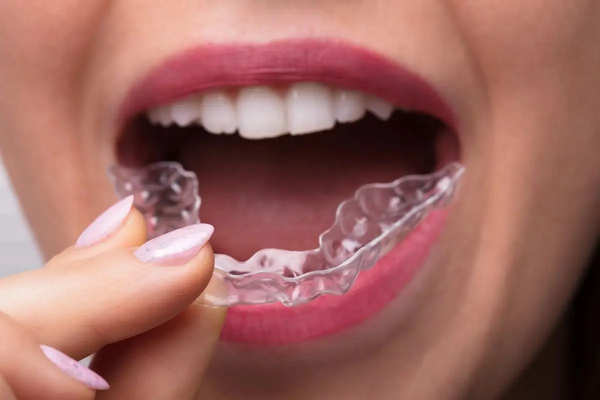 Woman holding clear Invisalign aligner tray showing teeth straightening treatment option.