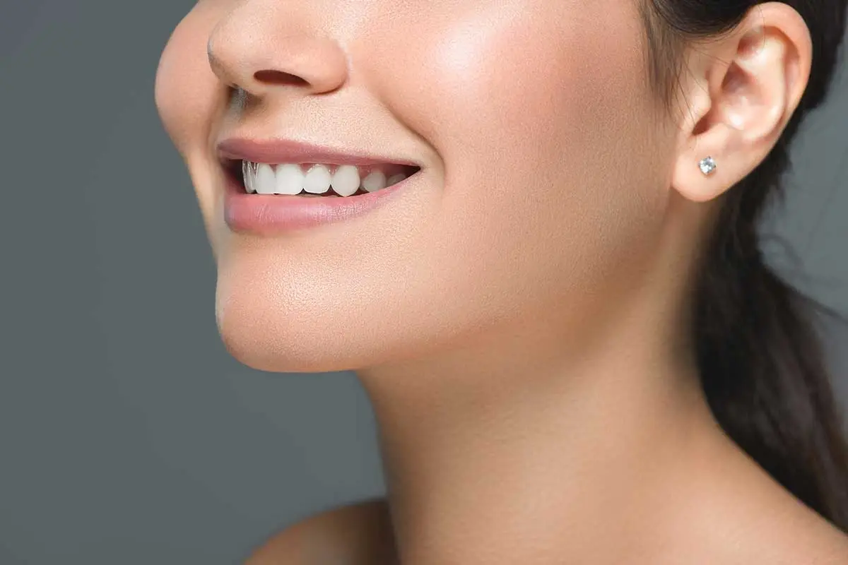 Woman smiling showing white teeth and healthy gums after cosmetic dental treatment in Orlando.