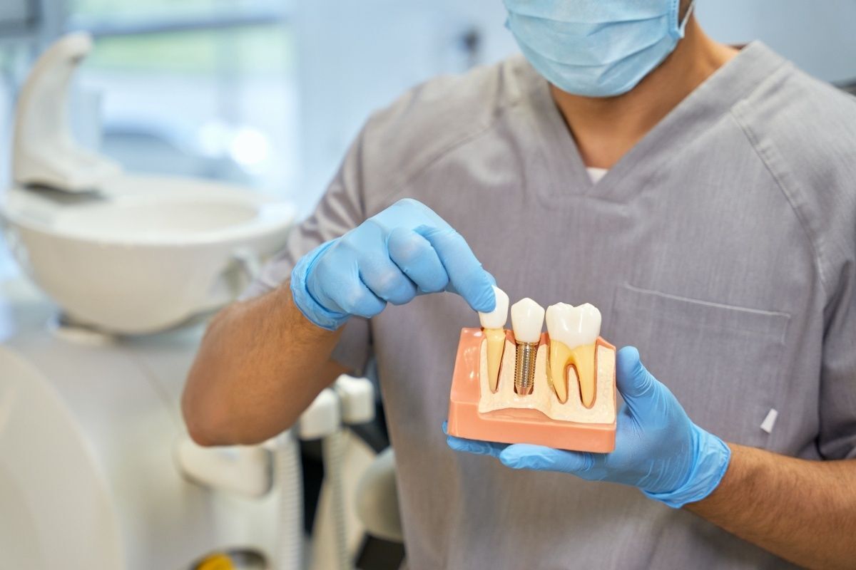 Dentist holding dental implant model showing tooth replacement procedure in Orlando office.